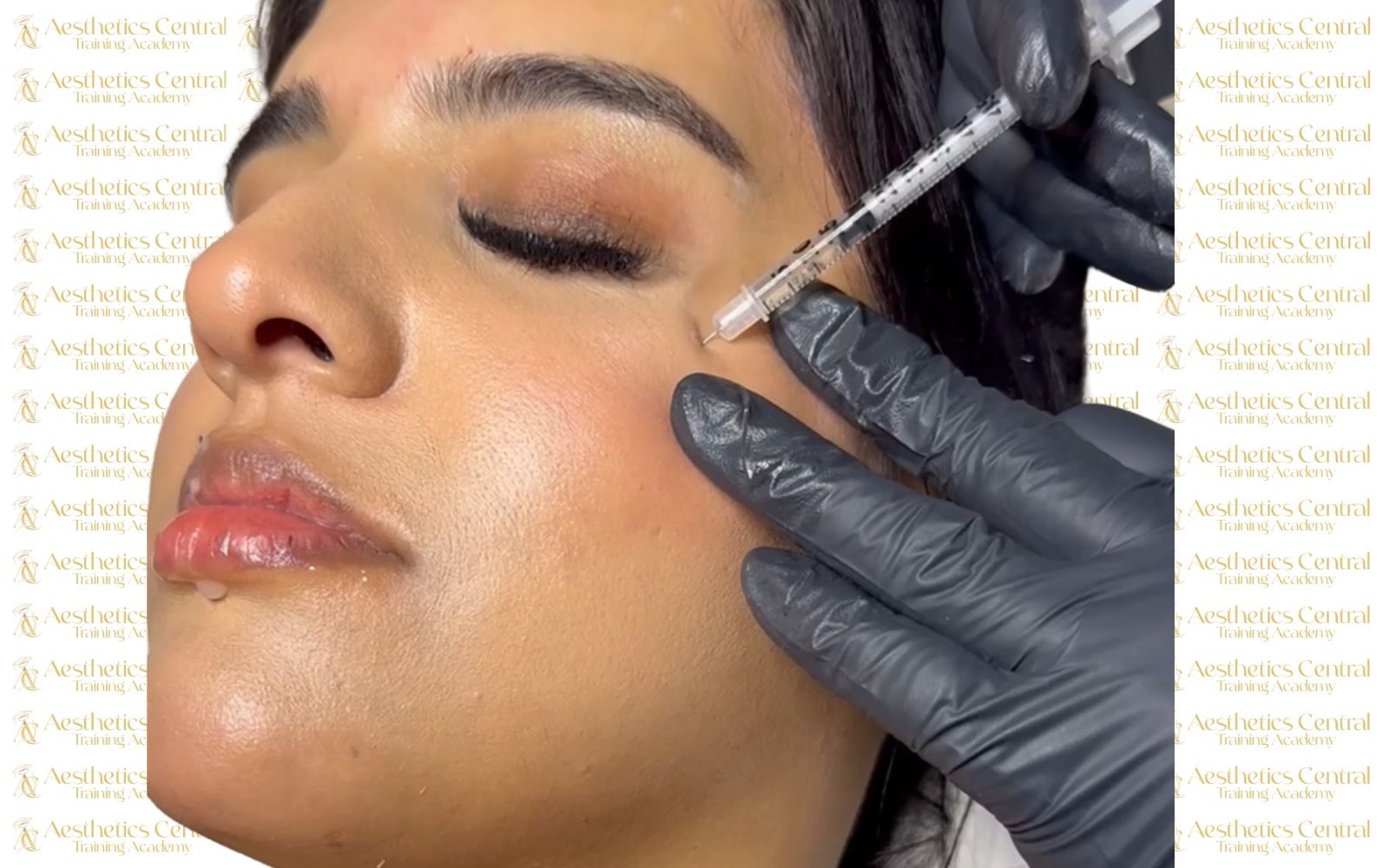 Foundation Botulinum Toxin