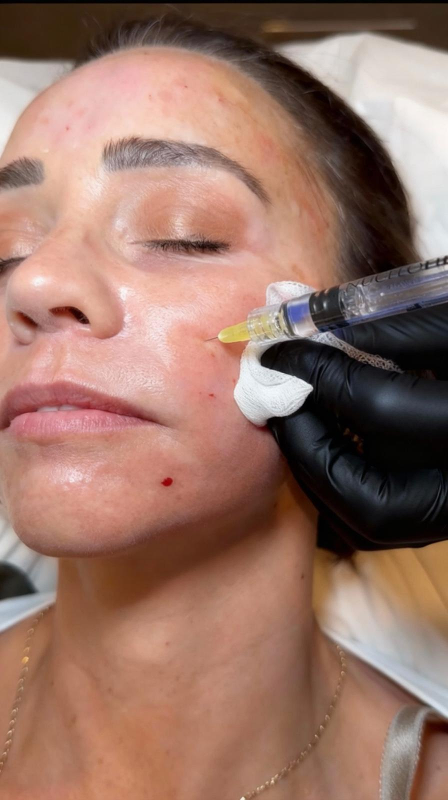 Advanced Skin Boosting Therapy
